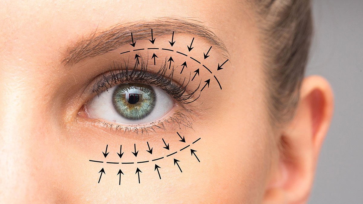 rejuvenece-tu-mirada-blefaroplastia-cirugia-de-parpados-ambulatoria-en-marbella