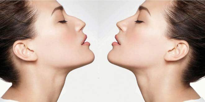 cirugia-plastica-facial